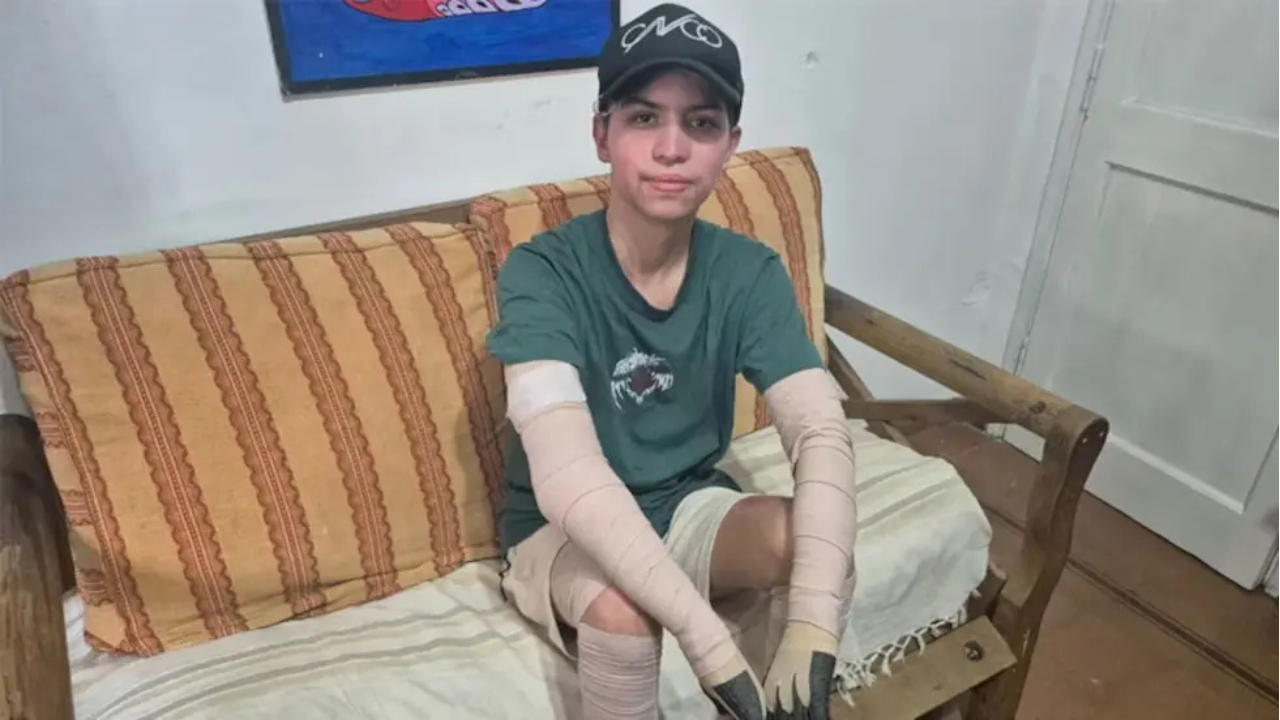 Benjamín (16) recibió el alta tras dos meses de internación y su familia solicitó a la Justicia investigar presuntas fallas de fábrica en un teléfono comercializado como "gamer".