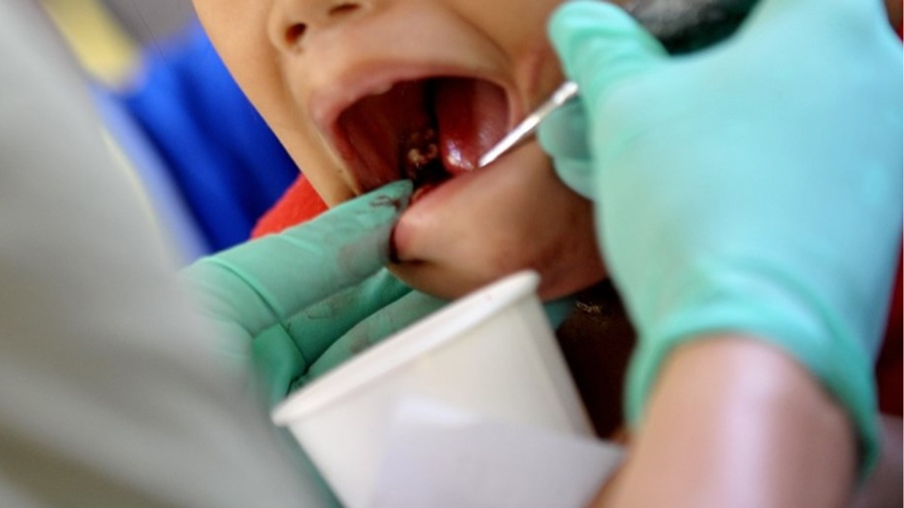 El juez Ricardo Moine dictó una condena de un año y seis meses de prisión y tres años de inhabilitación para ejercer su profesión a dos odontólogas por sacarle dientes "sin necesidad" a un nene.