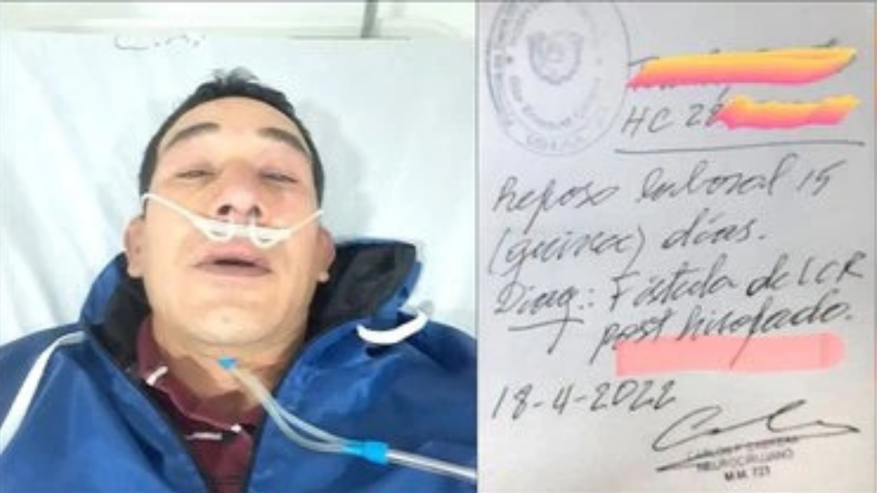 Ocurrió en Tierra del Fuego. Una médica fue denunciada por mala praxis luego de que le perforara el cráneo a un hombre al hisoparse.