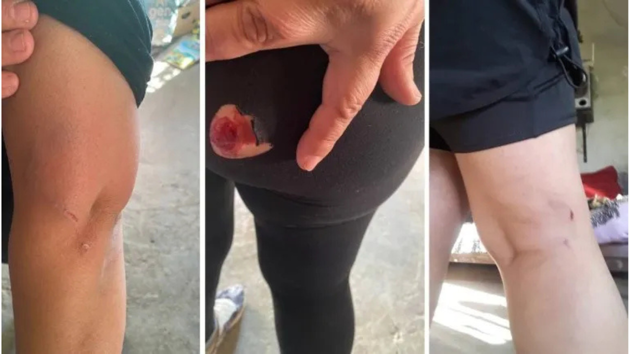 Los perros salieron de una vivienda, ubicada en el barrio 8 de Agosto de Centenario, y mordieron a la víctima en diferentes partes del cuerpo.