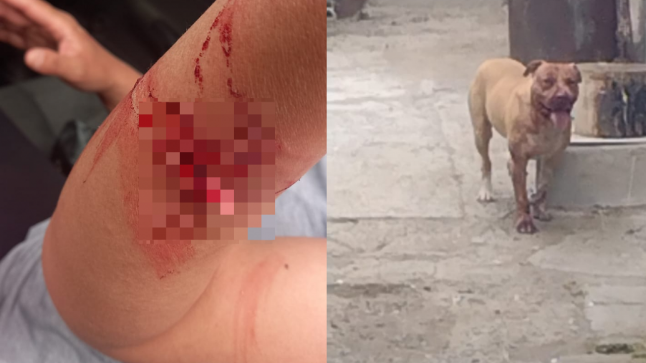El perro se había escapado de un domicilio mientras sus dueños no se encontraban. Enseguida atacó a una mujer que pasaba por el sector, provocándole un profundo corte en el brazo. También hizo lo mismo con otra perra, a la que hirió de gravedad.