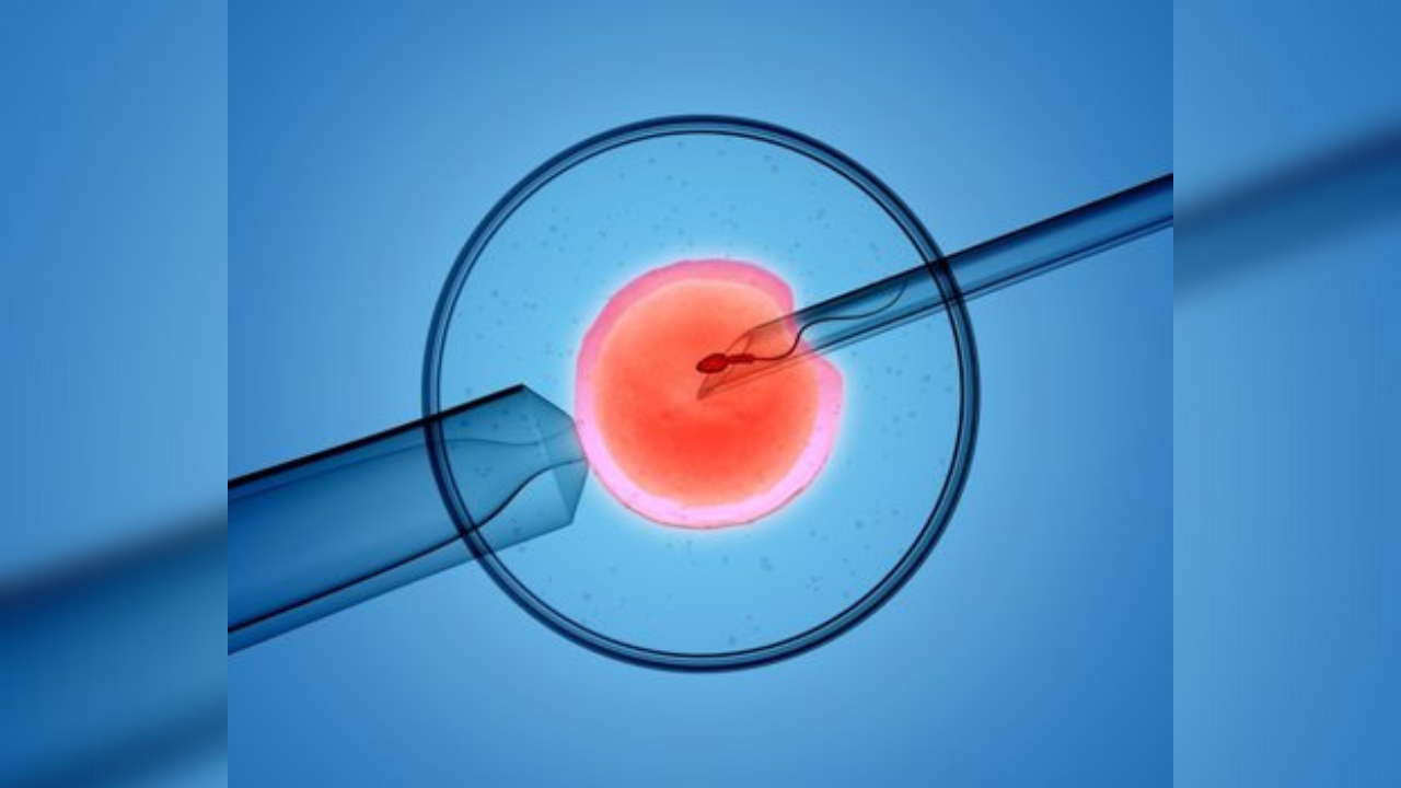 La transferencia del embrión incorrecto a un paciente, es un evento que
puede ocurrir, dentro de la infinita lista de errores humanos que se
cometen en la actividad médica, pero que resultan inaceptables e
inesperables para todas las partes involucradas.